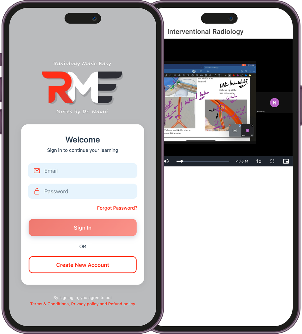 In-App RME Notes